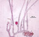 5 - Tetrasporofito con tetrasporociste